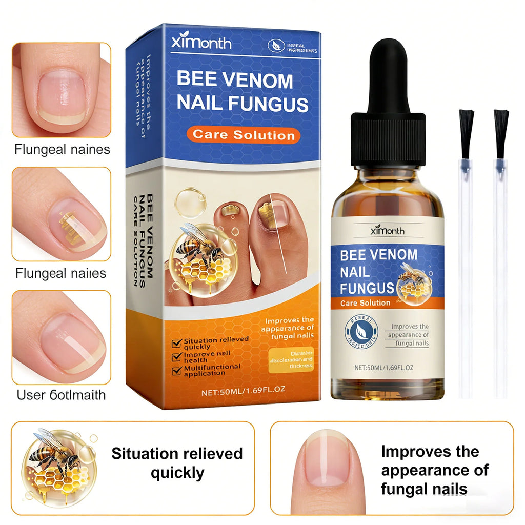 Nail Fungus Care Solution – Anti-Infection Repair Essence for Hands & Feet